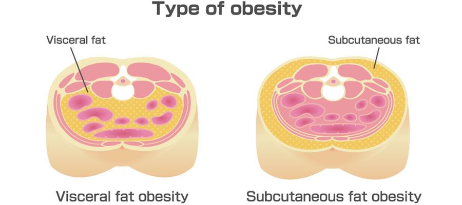 The Battle of the Bulge: Beating Visceral Fat!