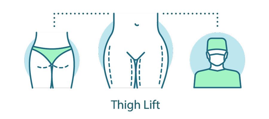 Medial Thigh Lift: The Fundamentals