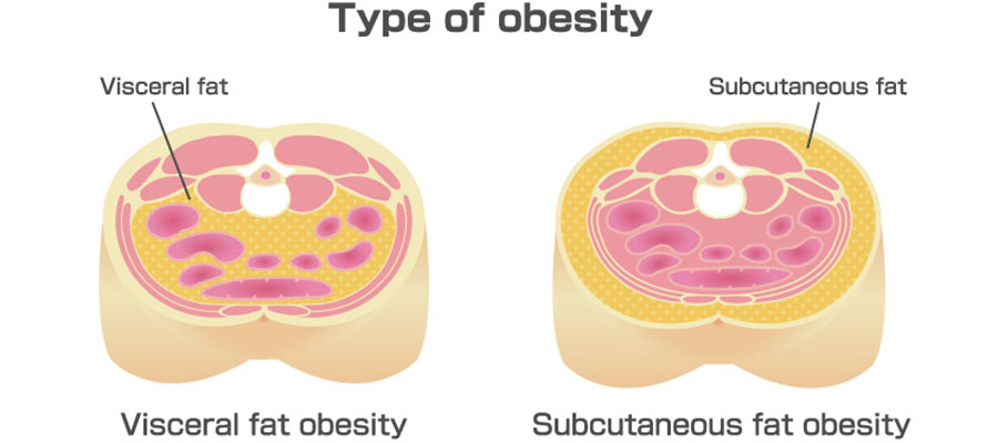 Diagram of types of fat: visceral and subcutaneous