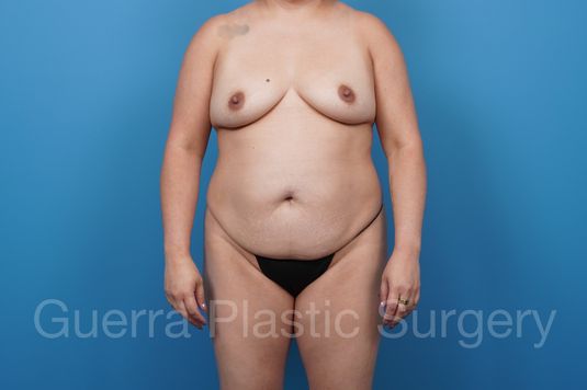 next Case #39796 Before