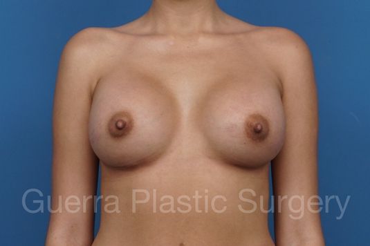 Case #29290 After