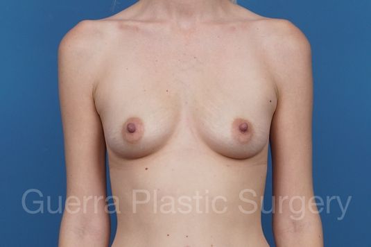 Case #29243 Before