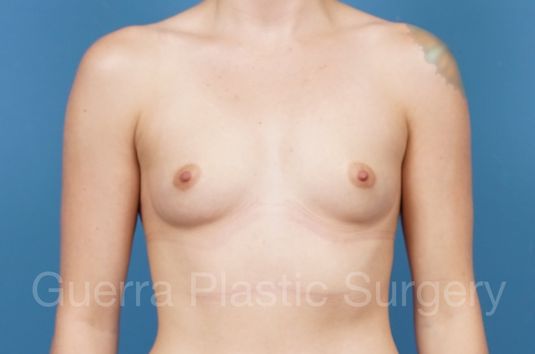 next Case #35963 Before