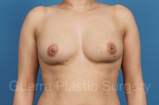 Case #34553 Before