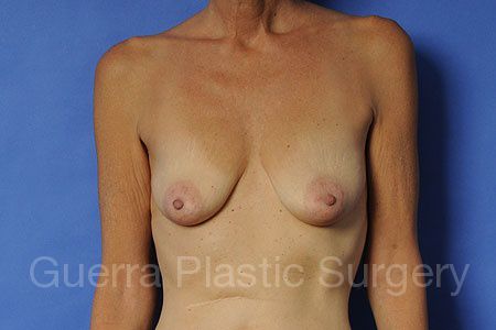 Case #30973 Before