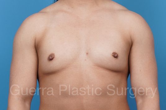 prev Case #38801 Before