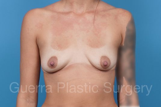prev Case #18994 Before