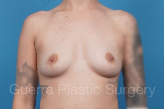prev Case #44120 Before