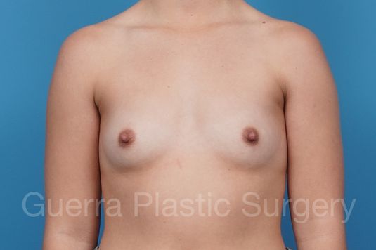next Case #43652 Before