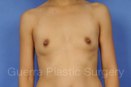 Case #35769 Before