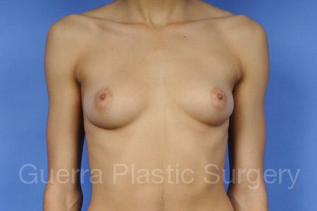 Case #35876 Before
