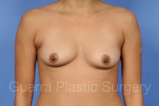 Case #1002002 Before