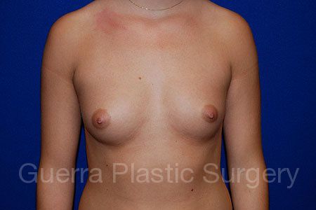 Case #19076 Before