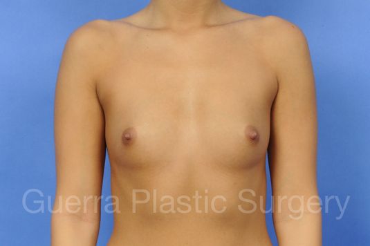 prev Case #1002023 Before