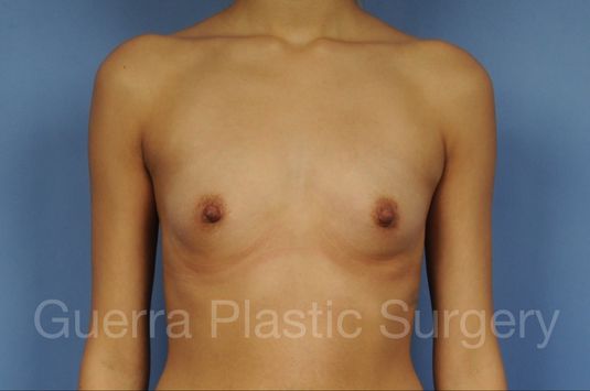 Case #1002032 Before