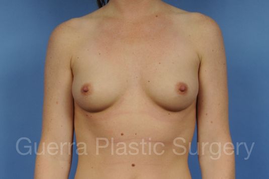 prev Case #1001120 Before