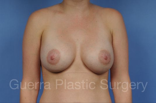 Case #1001159 After
