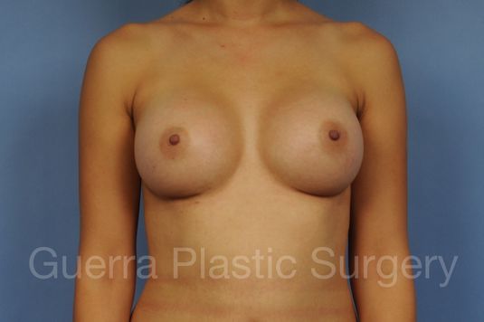 Case #1001168 After
