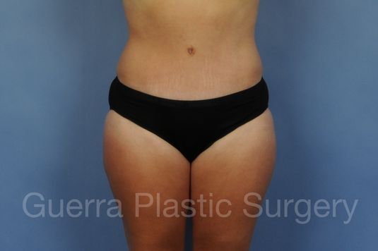 Case #01305 After