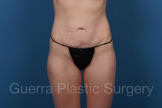 prev Case #36742 Before