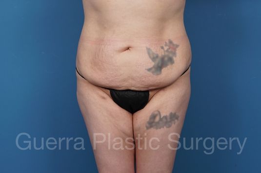 prev Case #36894 Before