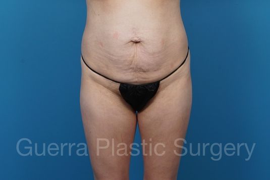 prev Case #37066 Before