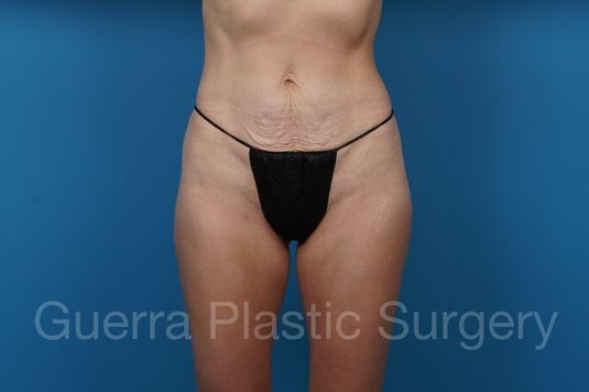 prev Case #37261 Before