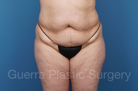 prev Case #37007 Before