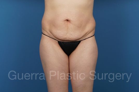 prev Case #35756 Before