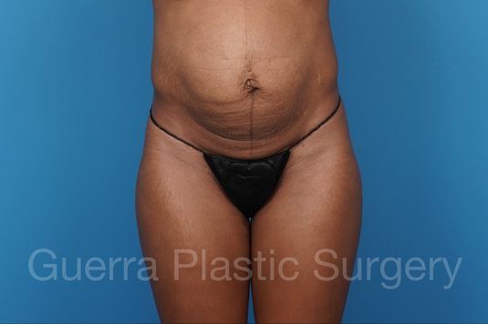 prev Case #40413 Before