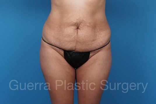 prev Case #37710 Before