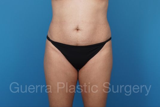 prev Case #34039 Before