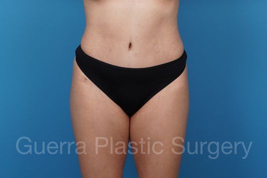 prev Case #34039 After
