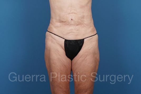 prev Case #34686 Before