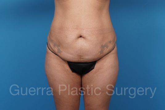 next Case #8712 Before