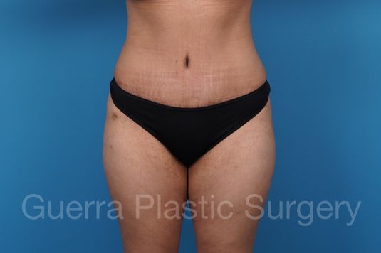 next Case #8712 After