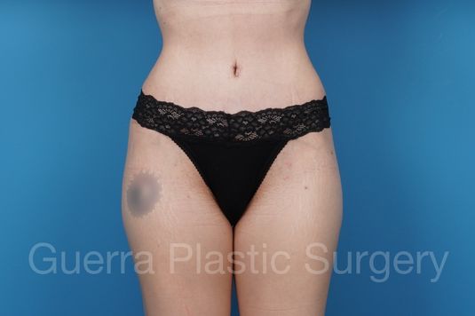prev Case #30589 After
