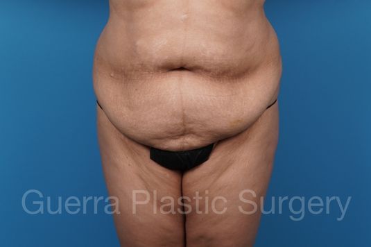 prev Case #40613 Before