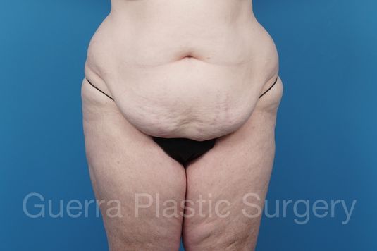 prev Case #39454 Before