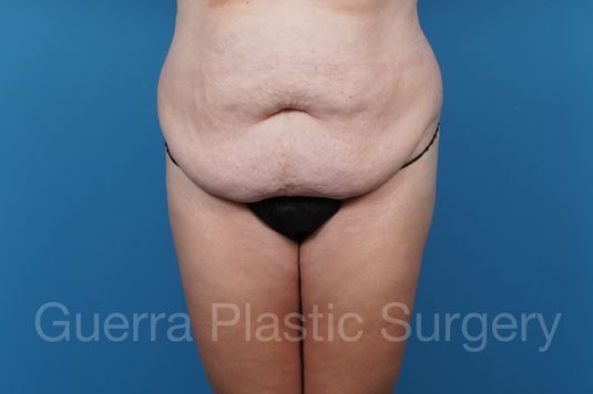 prev Case #35595 Before