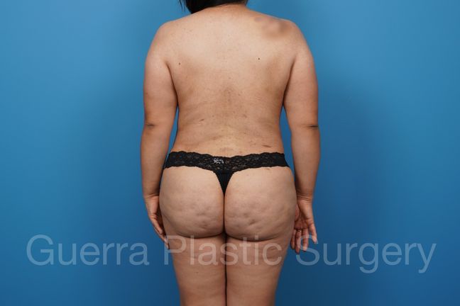 After Photo 7