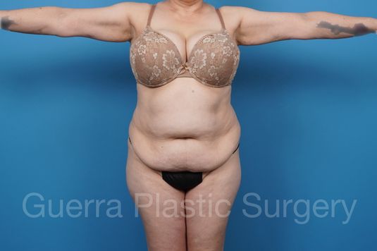 prev Case #40912 Before