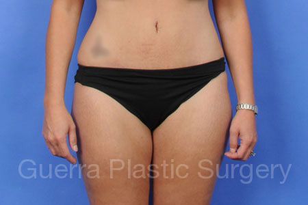 Case #31637 After