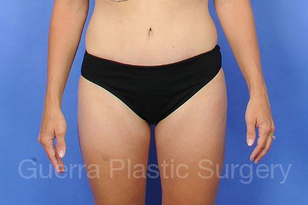 next Case #35986 After