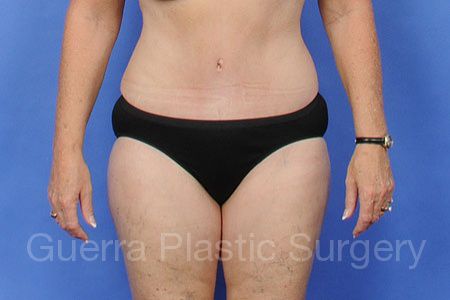 Case #30727 After
