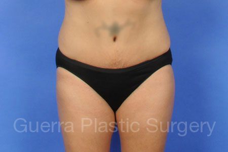 Case #30972 After