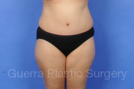 Case #309472 After