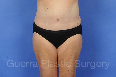 Case #30934 After