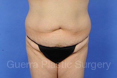 prev Case #31754 Before
