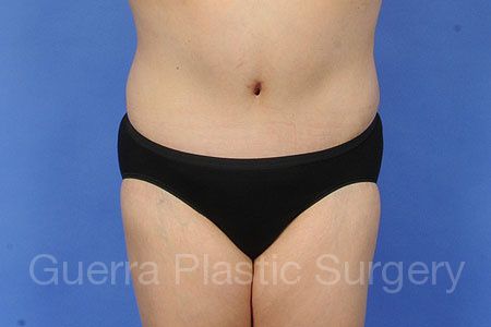 prev Case #31754 After